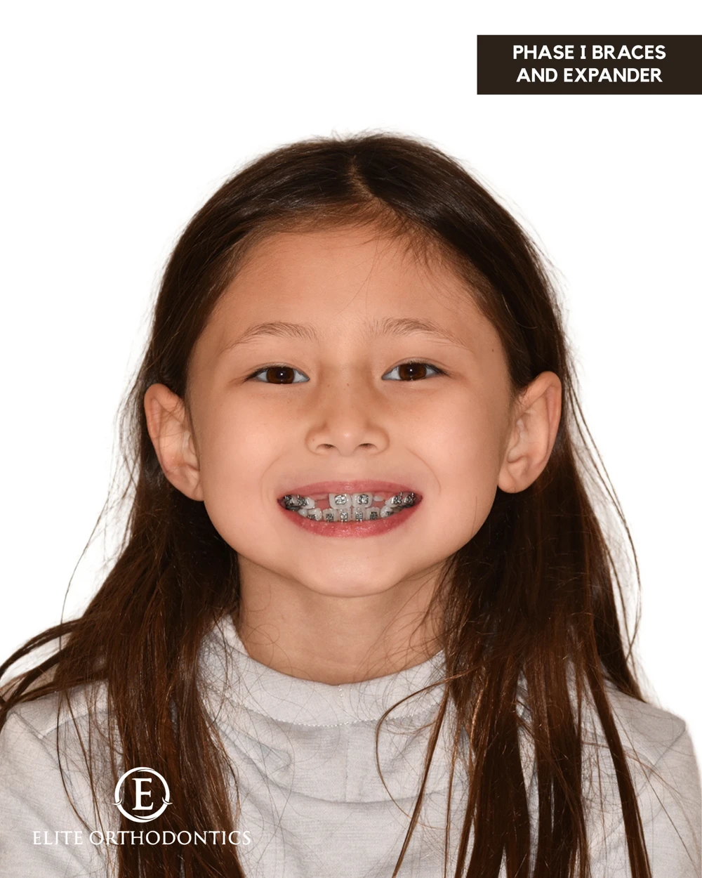 Making room for development.: clinical image 4 of 8