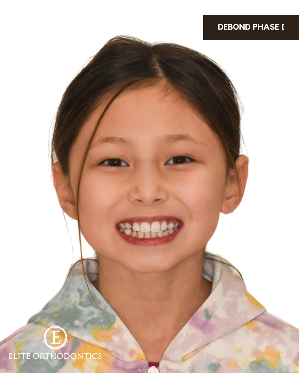 Making room for development.: clinical image 5 of 8