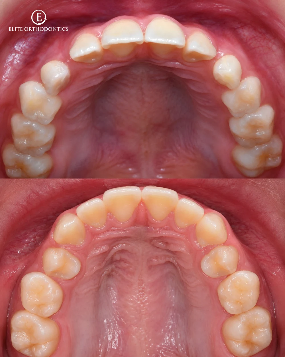 Making room for development.: clinical image 6 of 8