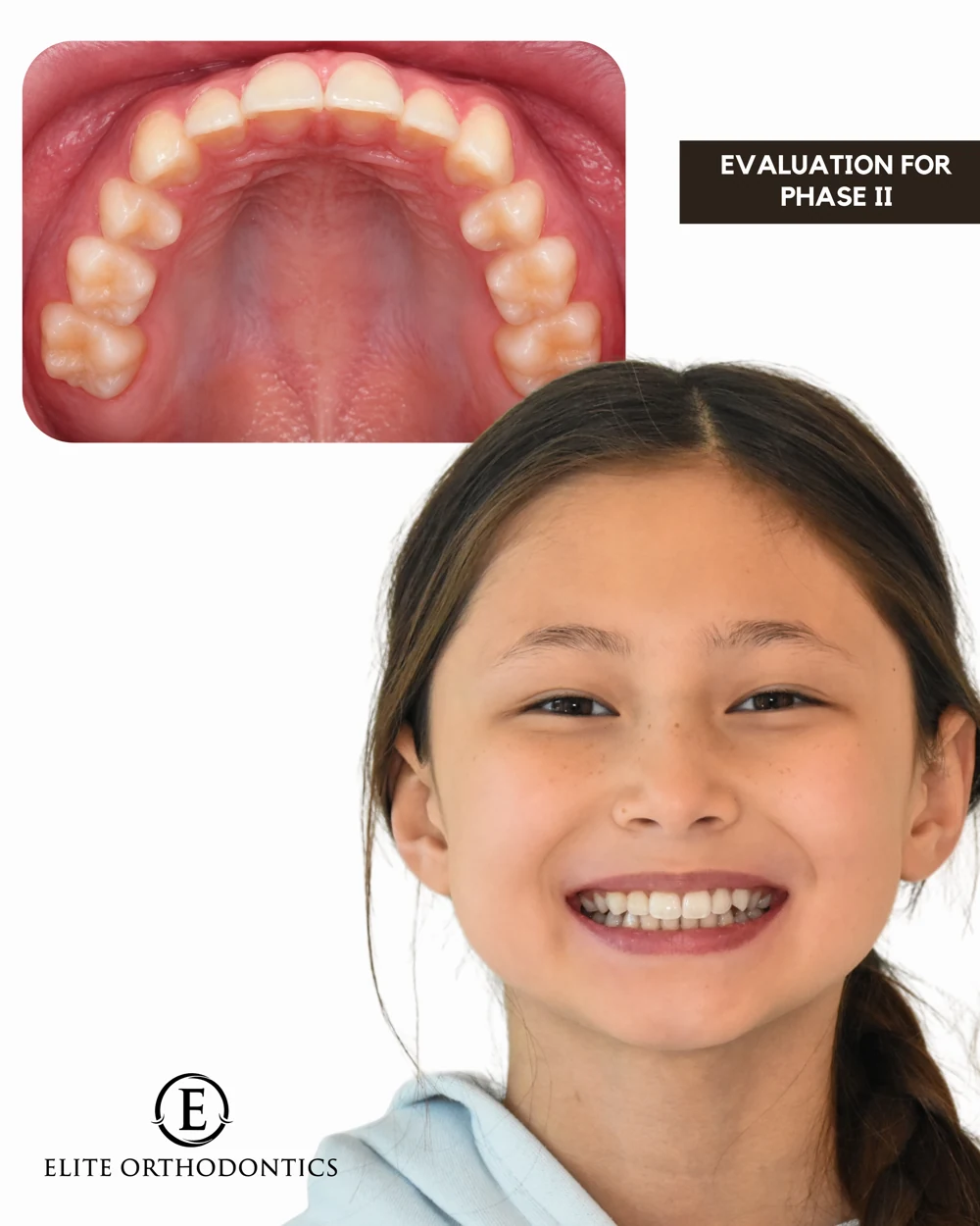 Making room for development.: clinical image 8 of 8